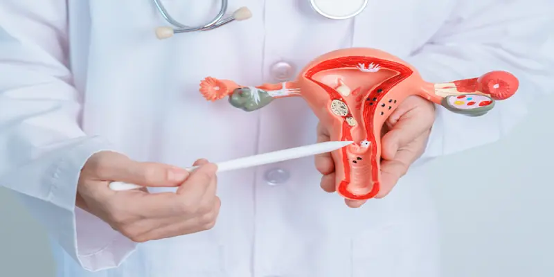 Uterine Fibroids (Myomectomy)